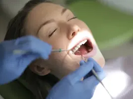 Deep Teeth Cleaning Deep Teeth Cleaning
