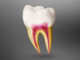 Root Canal Treatment Root Canal Treatment